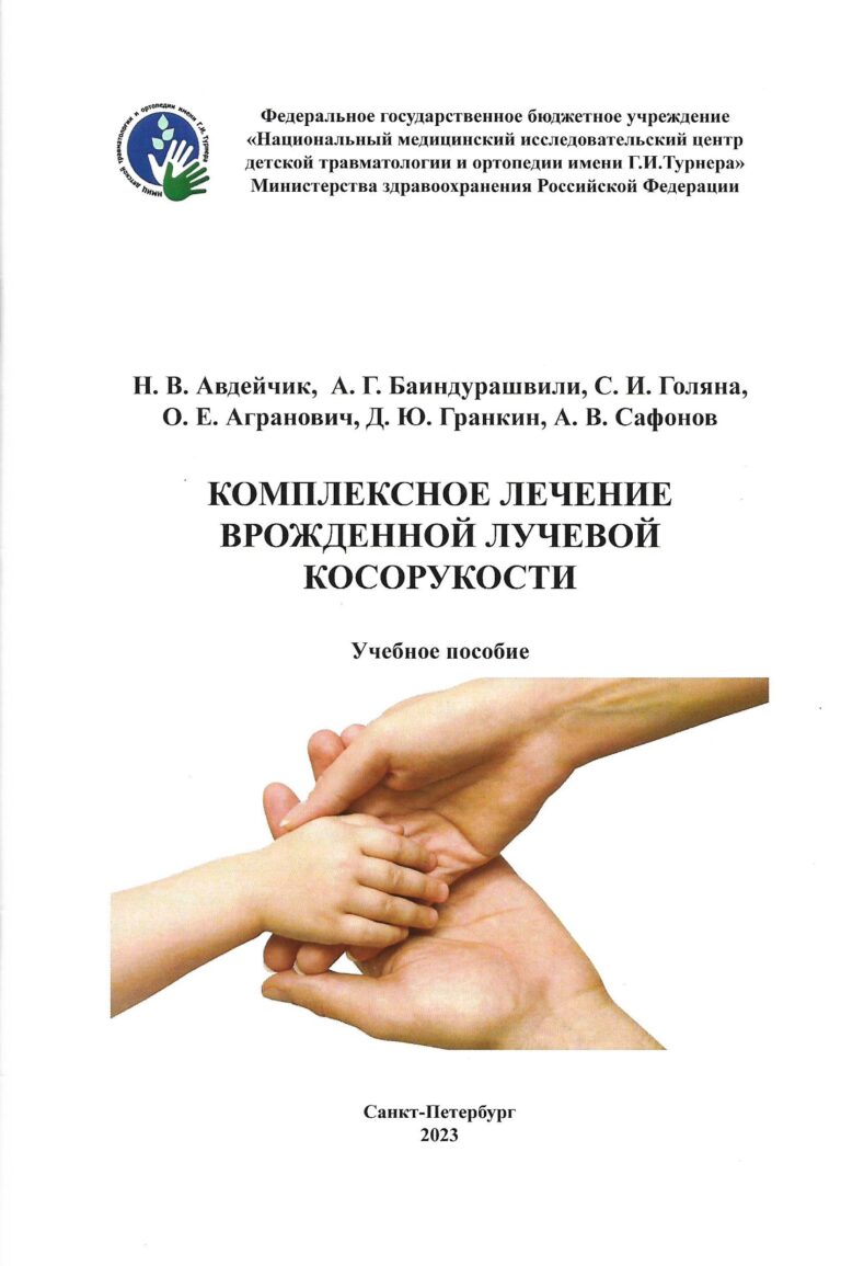 Подробнее о статье Комплексное лечение врожденной лучевой косорукости