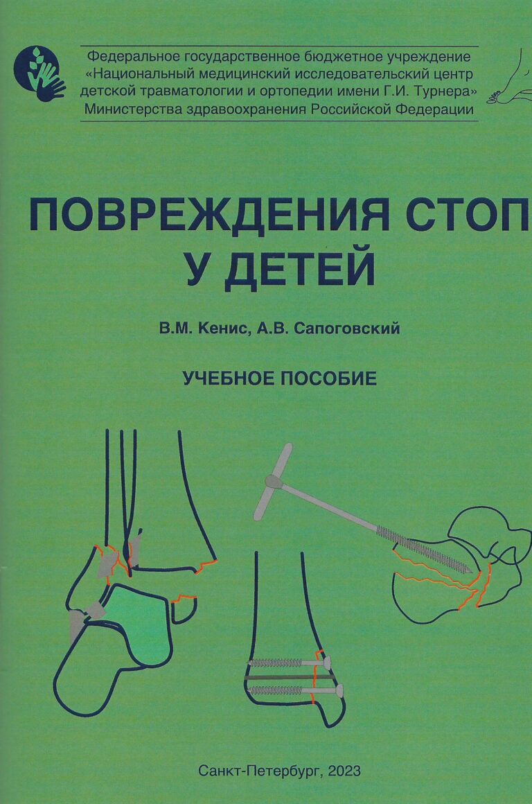 Подробнее о статье Повреждения стоп у детей