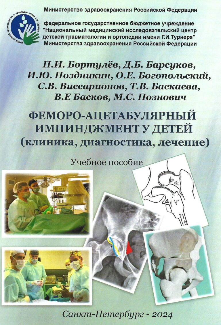 Подробнее о статье Феморо-ацетабулярный импинджмент у детей